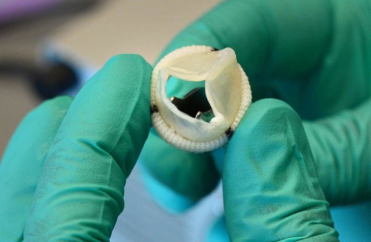 Heart valves